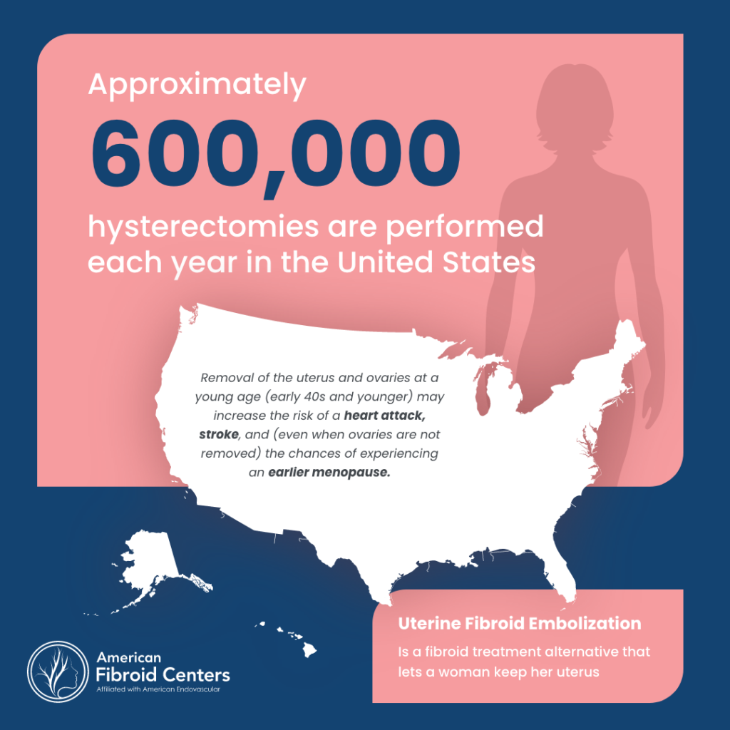 UFE Hysterectomy infographic
