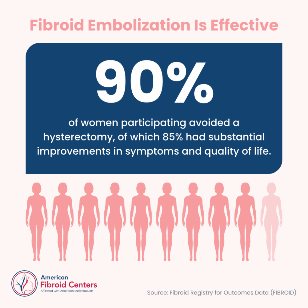 Fibroid Embolization Graphic