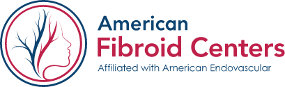 American Fibroid Centers